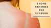 5 Home Remedies for Sunburn